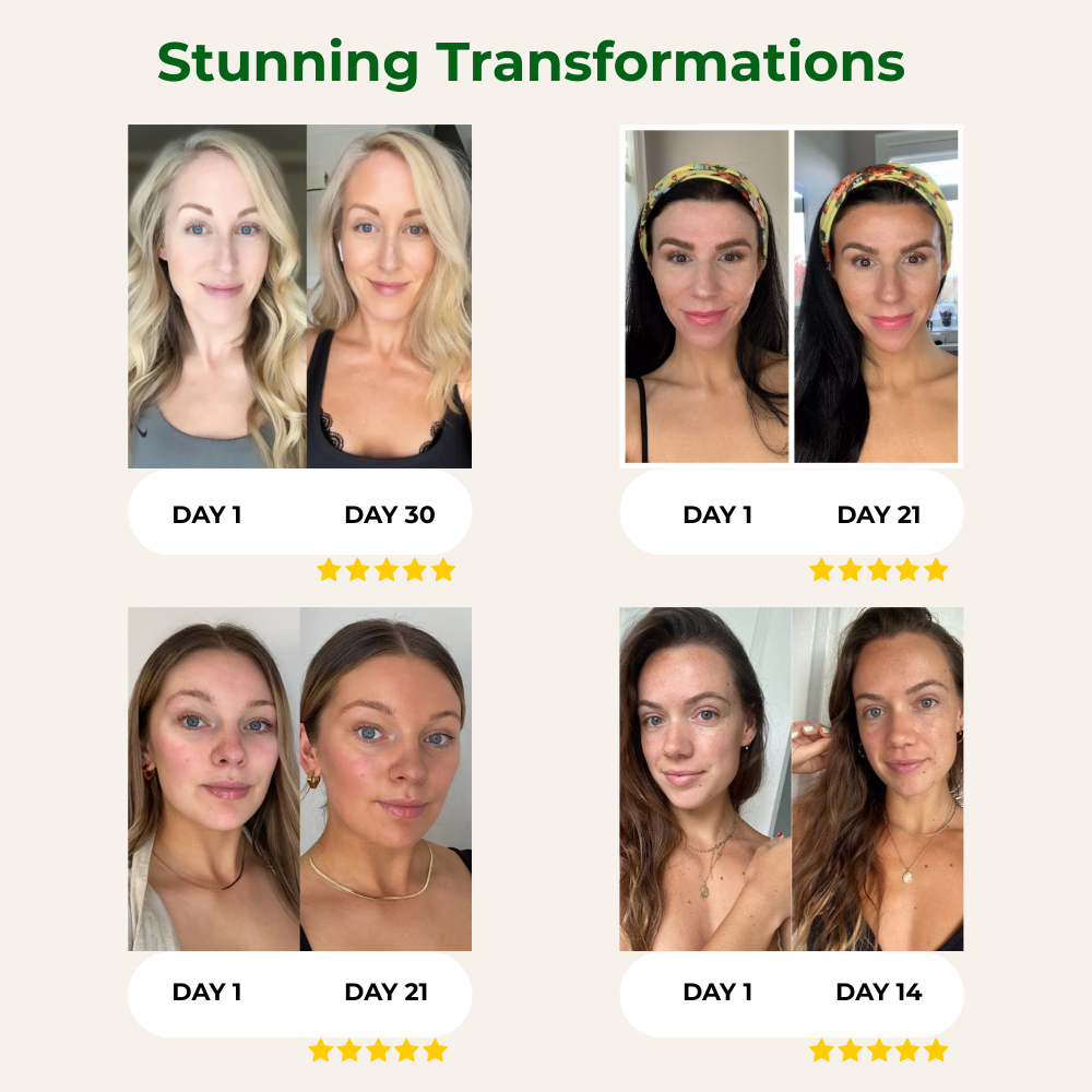 Kiyomi Astaxanthin Softgels