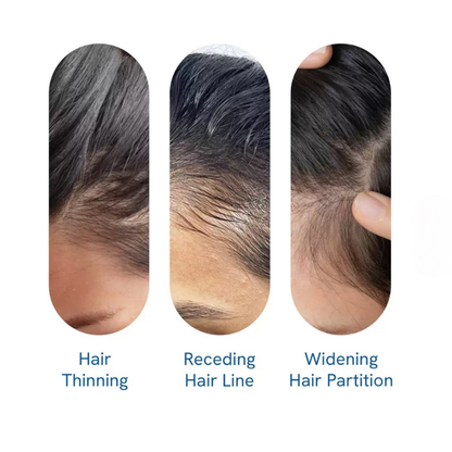 Kiyomi Hair Growth Serum Roll-On