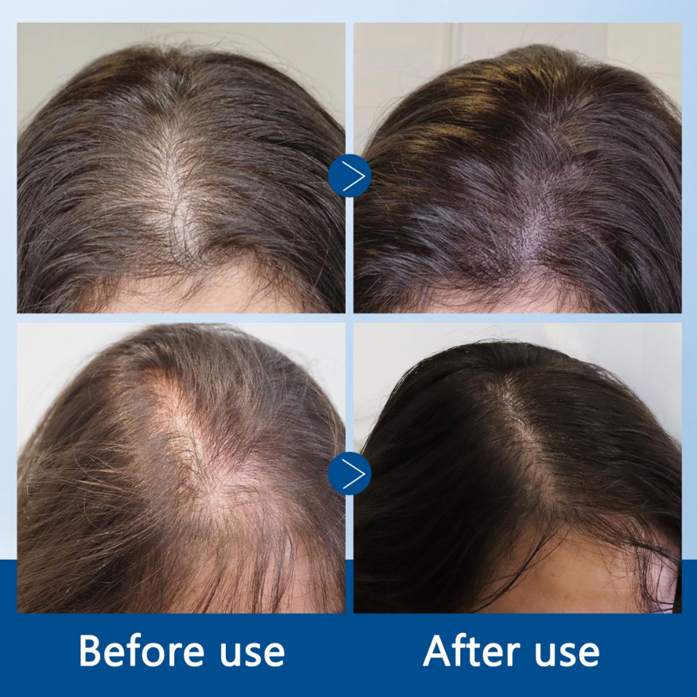 Kiyomi Hair Growth Serum Roll-On