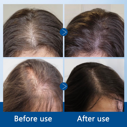 Kiyomi Hair Growth Serum Roll-On