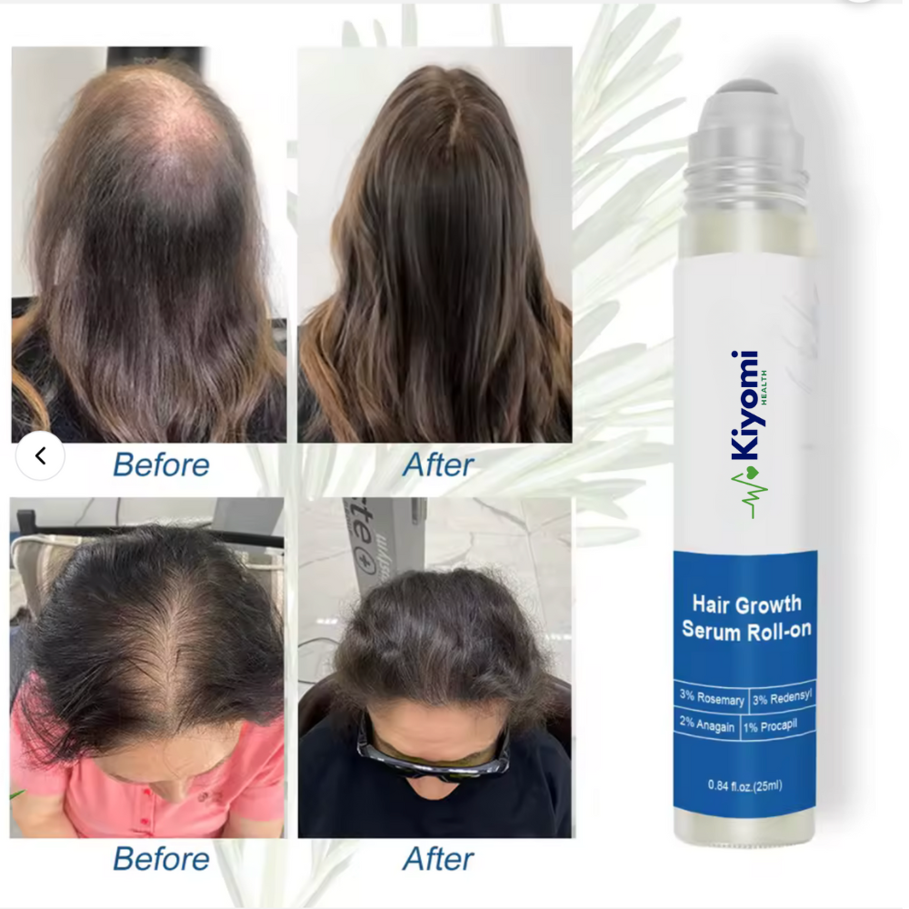 Kiyomi Hair Growth Serum Roll-On