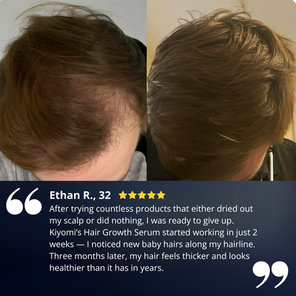 Kiyomi Hair Growth Serum Roll-On