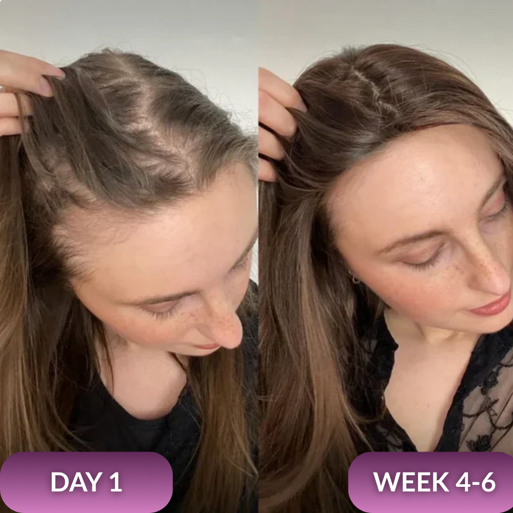 Kiyomi Hair Growth Booster